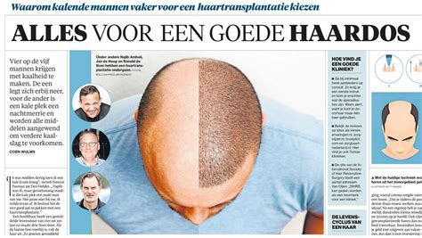 Waarom Kiezen Voor Een Haartransplantatie?